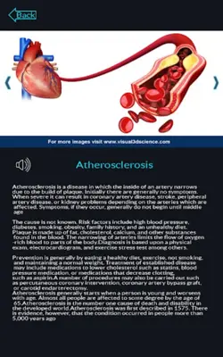 Circulatory System Anatomy android App screenshot 4